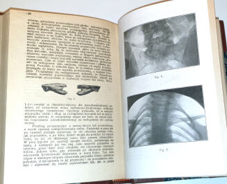 POLSKI PRZEGLĄD CHIRURGICZNY t.1-18 [18 wol.] wyd. 1922-39 - 7