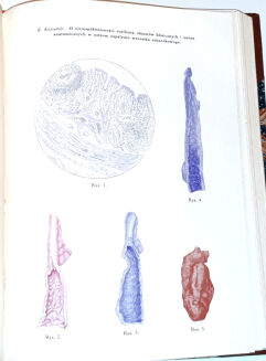 POLSKI PRZEGLĄD CHIRURGICZNY t.1-18 [18 wol.] wyd. 1922-39 - 9