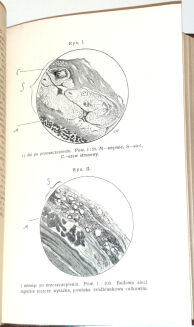 POLSKI PRZEGLĄD CHIRURGICZNY t.1-18 [18 wol.] wyd. 1922-39 - 10