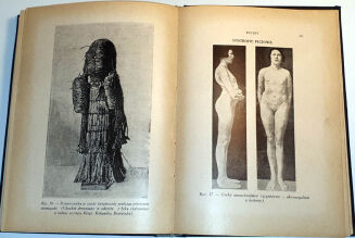 MARCUSE; HIGIER- ENCYKLOPEDIA WIEDZY SEKSUALNEJ t.1-4 [komplet w 4 wol.] wyd.1937 - 5