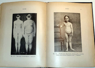 MARCUSE; HIGIER- ENCYKLOPEDIA WIEDZY SEKSUALNEJ t.1-4 [komplet w 4 wol.] wyd.1937 - 6