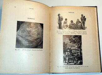 MARCUSE; HIGIER- ENCYKLOPEDIA WIEDZY SEKSUALNEJ t.1-4 [komplet w 4 wol.] wyd.1937 - 9