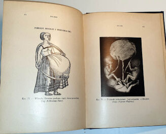 MARCUSE; HIGIER- ENCYKLOPEDIA WIEDZY SEKSUALNEJ t.1-4 [komplet w 4 wol.] wyd.1937 - 10