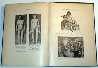 MARCUSE; HIGIER- ENCYKLOPEDIA WIEDZY SEKSUALNEJ t.1-4 [komplet w 4 wol.] wyd.1937 - 12