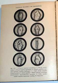 MARCUSE; HIGIER- ENCYKLOPEDIA WIEDZY SEKSUALNEJ t.1-4 [komplet w 4 wol.] wyd.1937 - 11