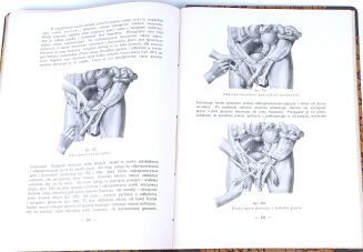 PASZKIEWICZ - TECHNIKA SEKCJI ZWŁOK. Warszawa 1923 - 7