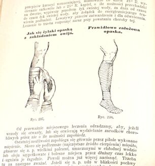 BILZ - NOWE LECZNICTWO PRZYRODNICZE t.1-2 (komplet w 2 wol.) - 23