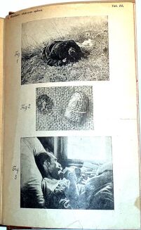 WACHHOLZ- MEDYCYNA SĄDOWA wyd. 1925 - 5