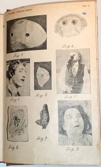 WACHHOLZ- MEDYCYNA SĄDOWA wyd. 1925 - 6