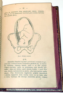 NAUKA POŁOŻNICZA DLA AKUSZEREK PAŃSTWA PRUSKIEGO WYD. 1879, 9 drzeworytów - 4