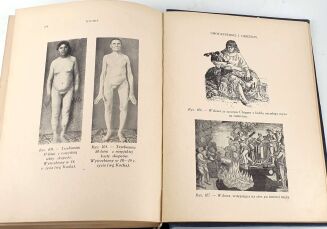 FREUD, MARCUSE; HIGIER- ENCYKLOPEDIA WIEDZY SEKSUALNEJ t.1-4 [komplet w 4 wol.] wyd.1937 - 8