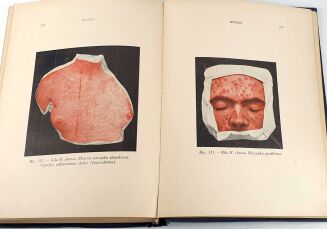 FREUD, MARCUSE; HIGIER- ENCYKLOPEDIA WIEDZY SEKSUALNEJ t.1-4 [komplet w 4 wol.] wyd.1937 - 9