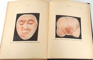 FREUD, MARCUSE; HIGIER- ENCYKLOPEDIA WIEDZY SEKSUALNEJ t.1-4 [komplet w 4 wol.] wyd.1937 - 10