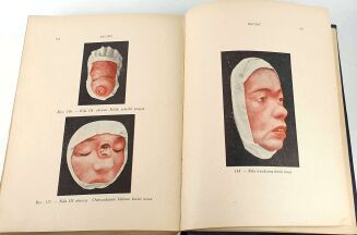 FREUD, MARCUSE; HIGIER- ENCYKLOPEDIA WIEDZY SEKSUALNEJ t.1-4 [komplet w 4 wol.] wyd.1937 - 11